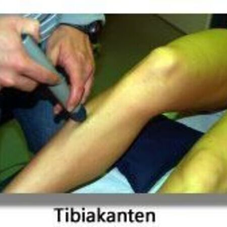 Tibiakanten
