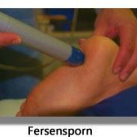 Fersensporn