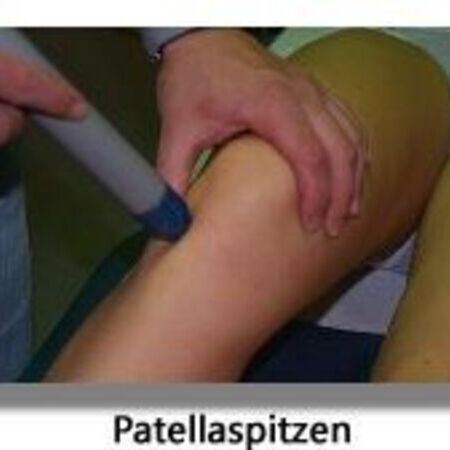 Patellaspitzen