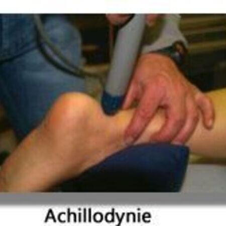 Achillodynie